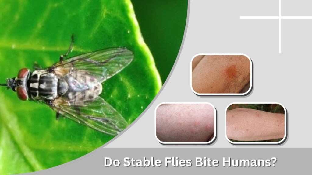 Do Stable Flies Bite Humans?