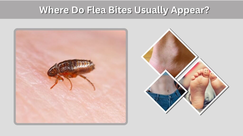 Where Do Flea Bites Usually Appear?