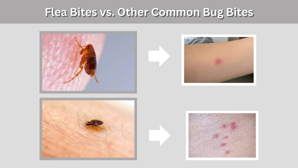 Flea Bites vs. Other Common Bug Bites