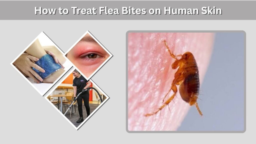 How to Treat Flea Bites on Human Skin