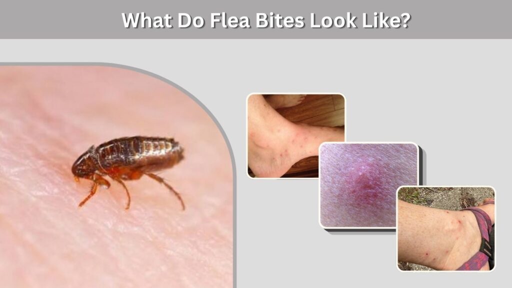 What Do Flea Bites Look Like?