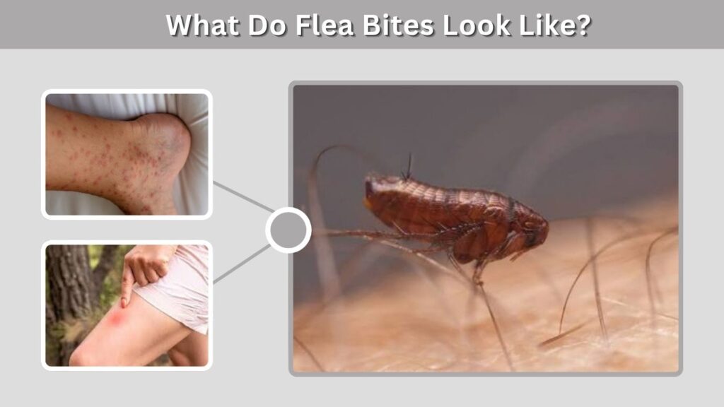 What Do Flea Bites Look Like?