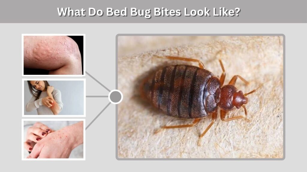 What Do Bed Bug Bites Look Like?