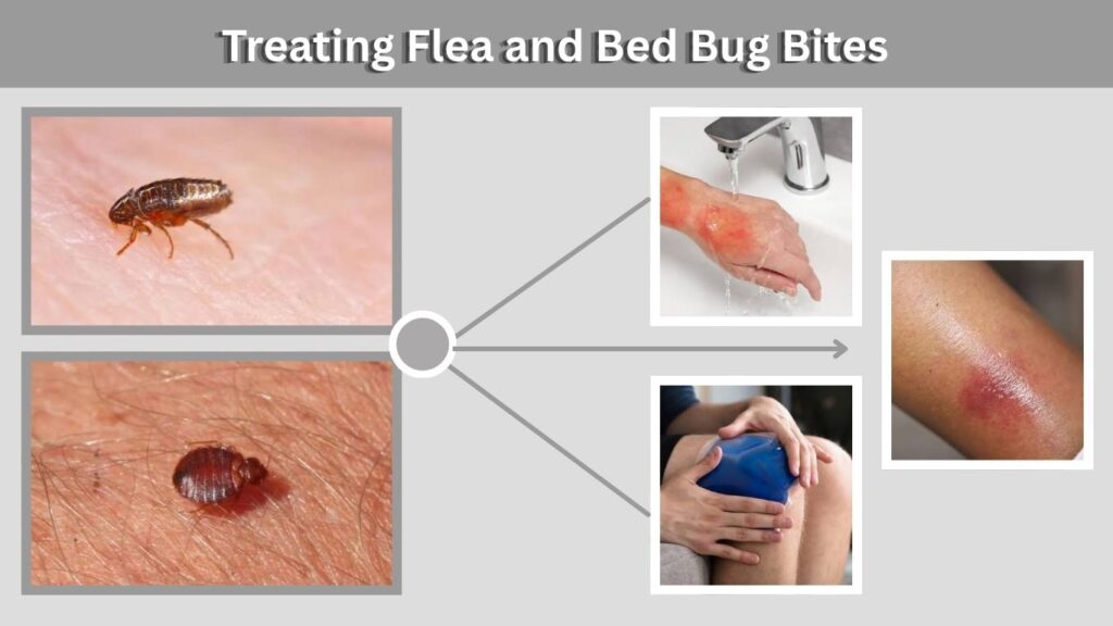 Treating Flea and Bed Bug Bites