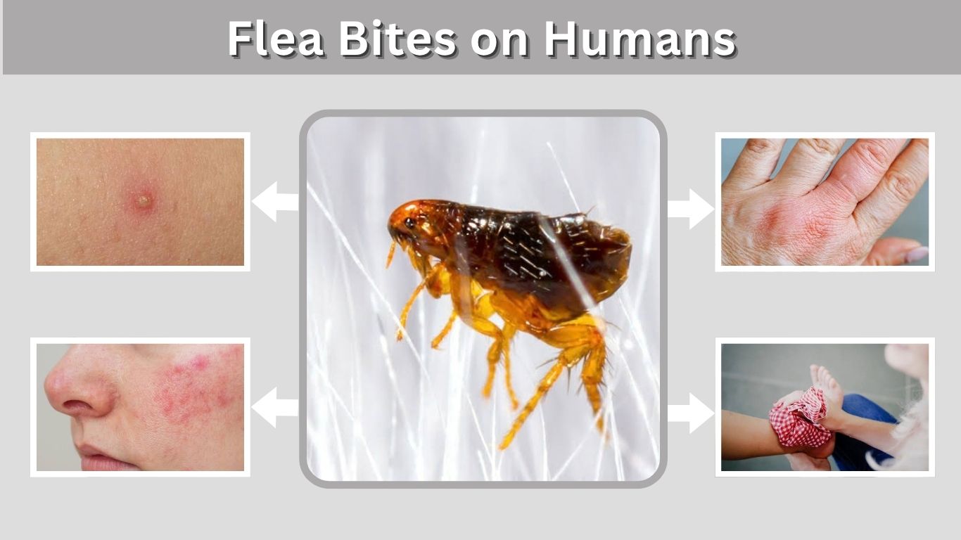 Flea Bites on Humans: Symptoms, Treatment and Prevention