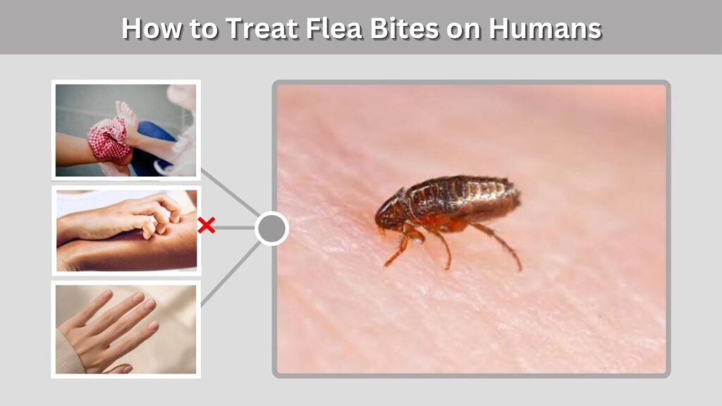 How to Treat Flea Bites on Humans