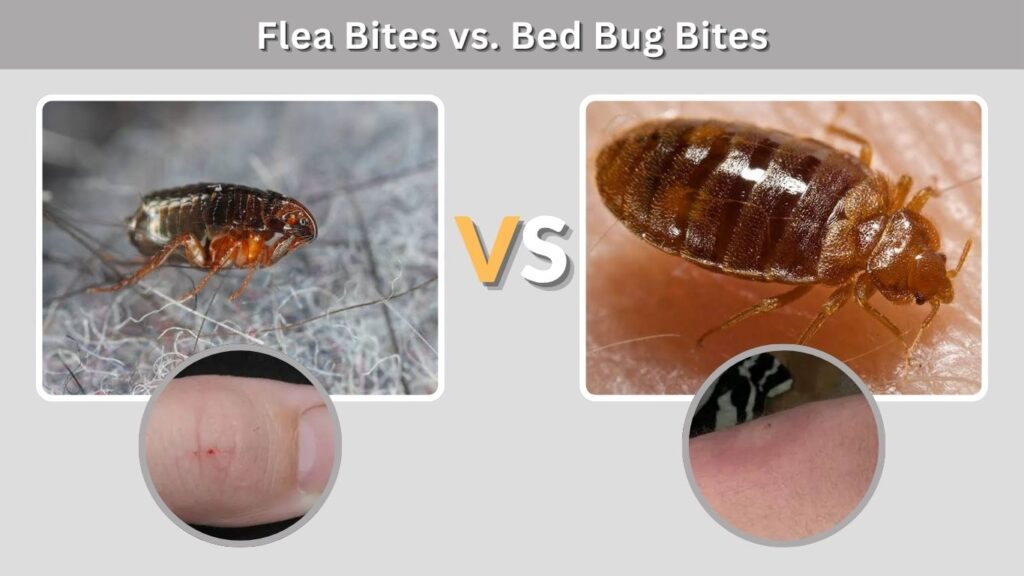 Flea Bites vs. Bed Bug Bites