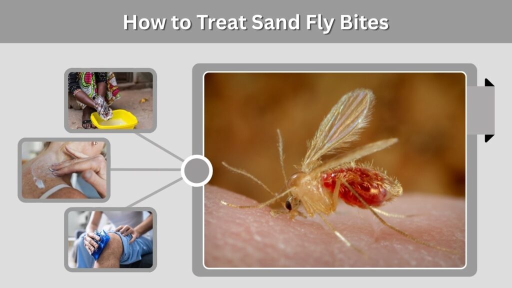How to Treat Sand Fly Bites