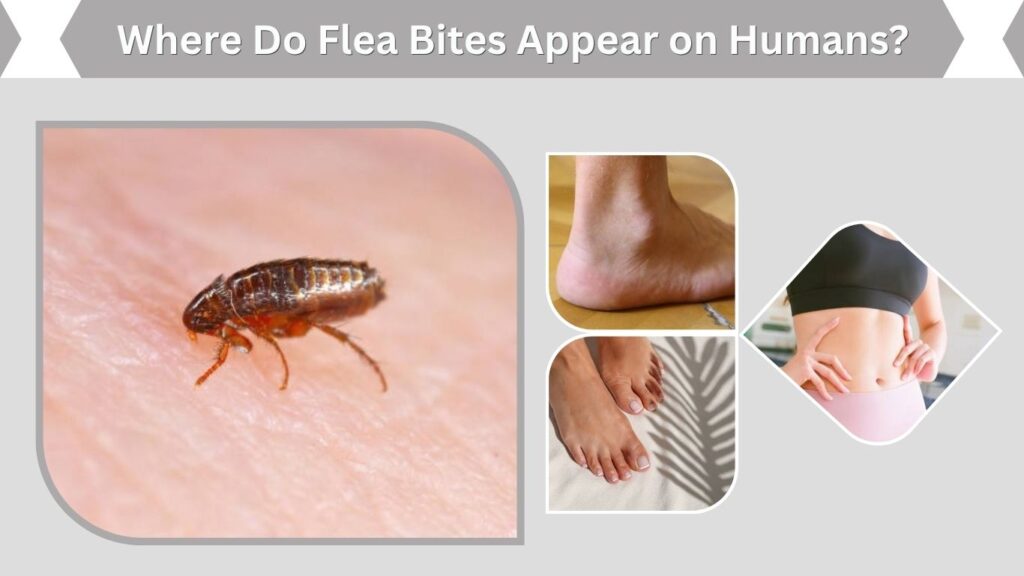 Where Do Flea Bites Appear on Humans?