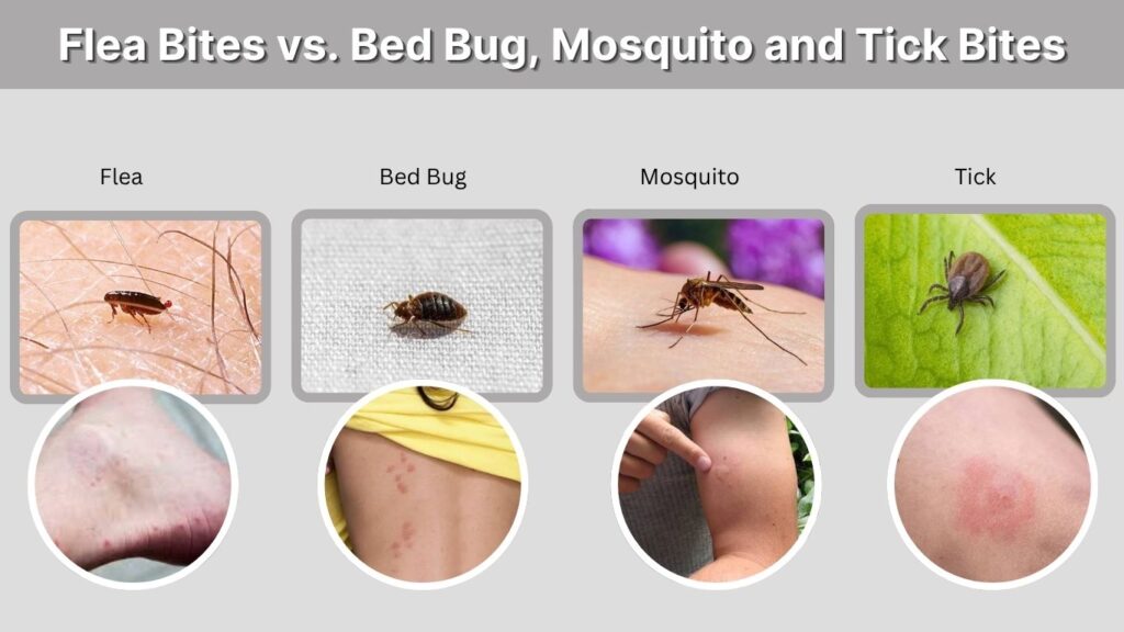 Flea Bites vs. Bed Bug, Mosquito and Tick Bites