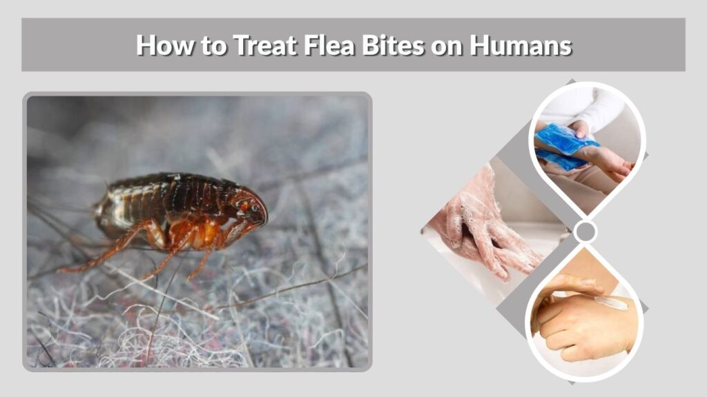 How to Treat Flea Bites on Humans