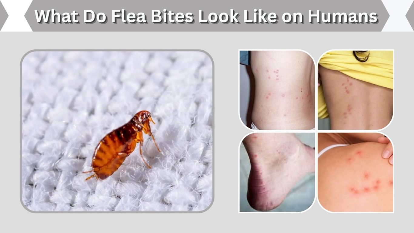 What Do Flea Bites Look Like on Humans? Signs & Symptoms