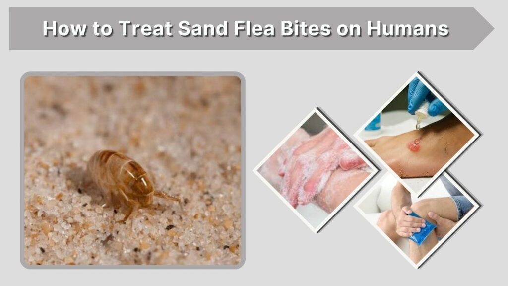 How to Treat Sand Flea Bites on Humans
