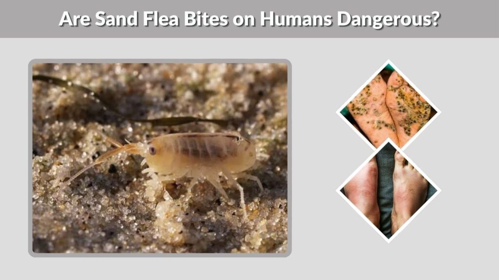 Are Sand Flea Bites on Humans Dangerous?