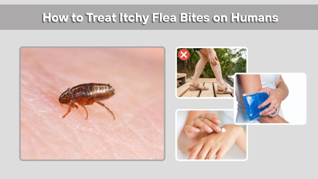 How to Treat Itchy Flea Bites on Humans