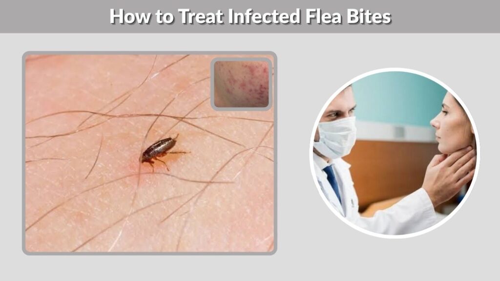 How to Treat Infected Flea Bites