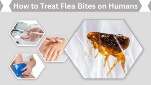 How to Treat Flea Bites on Humans: Fast Relief Guide