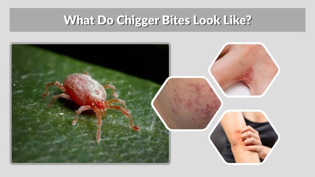 What Do Chigger Bites Look Like?