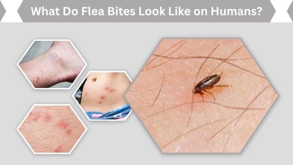 What Do Flea Bites Look Like on Humans?