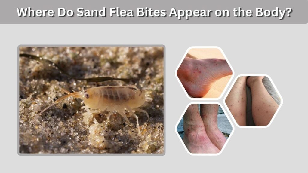 Where Do Sand Flea Bites Appear on the Body?