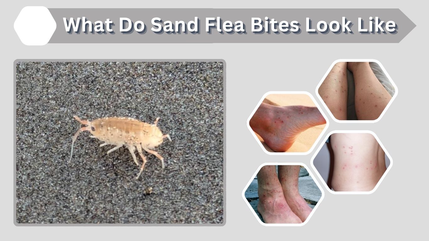 What Do Sand Flea Bites Look Like? Signs & Symptoms