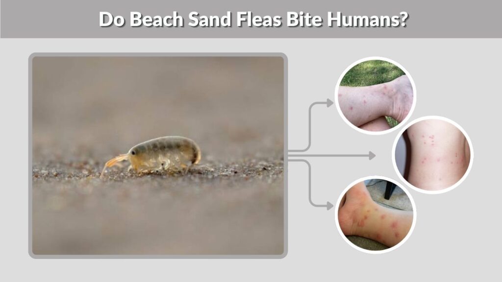Do Beach Sand Fleas Bite Humans?
