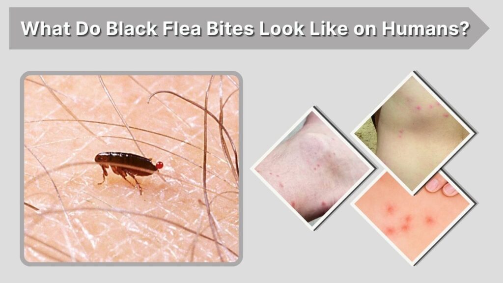What Do Black Flea Bites Look Like on Humans?