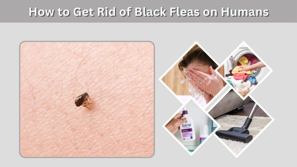 How to Get Rid of Black Fleas on Humans