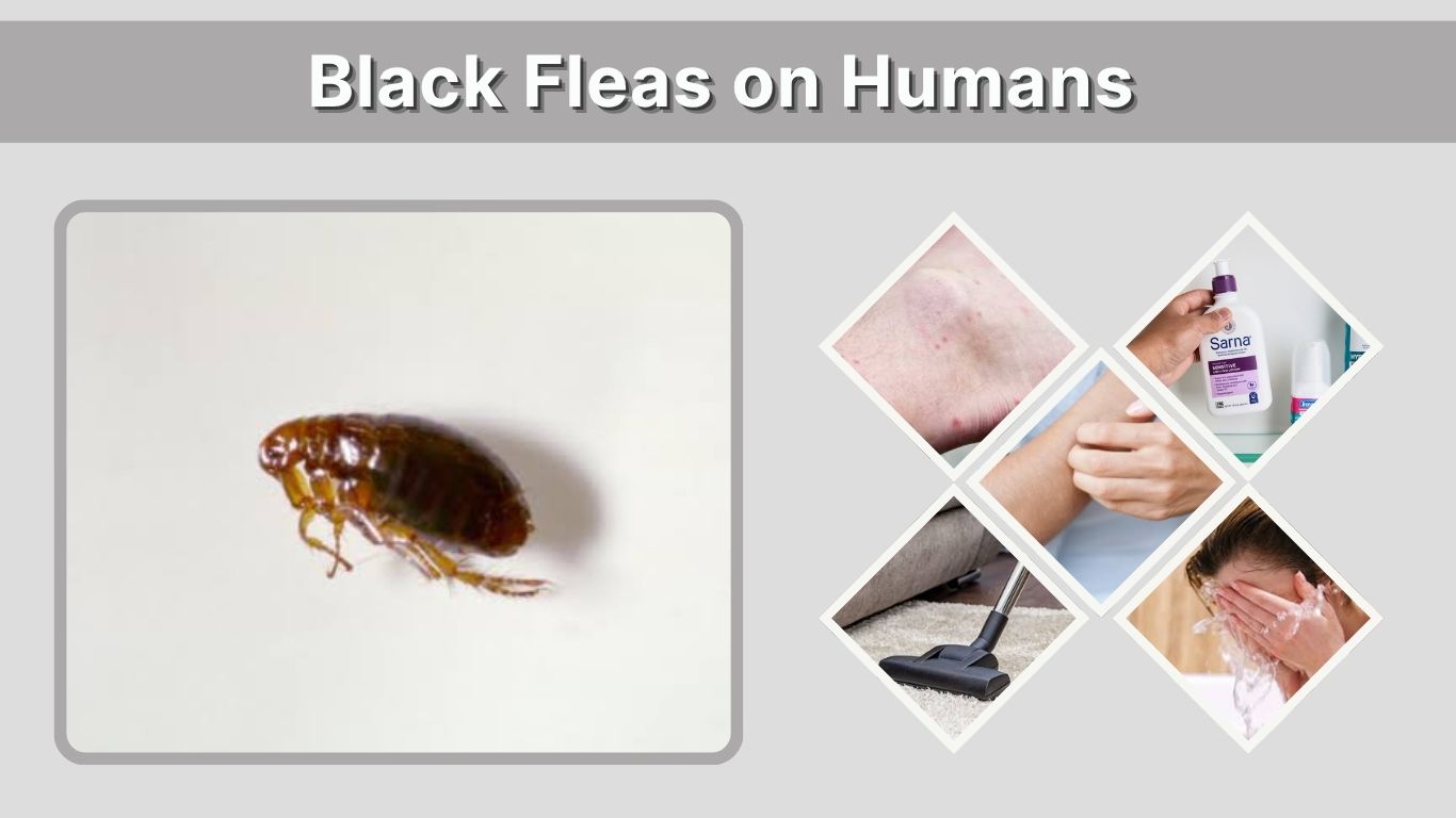 Black Fleas on Humans: Identification, Bites & Treatment