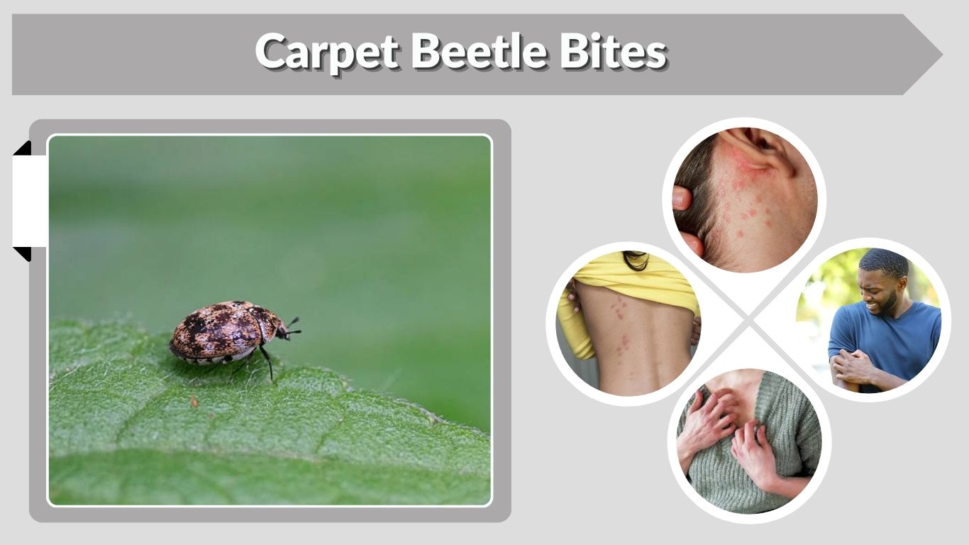 Carpet Beetle Bites: Symptoms, Rash & Treatment
