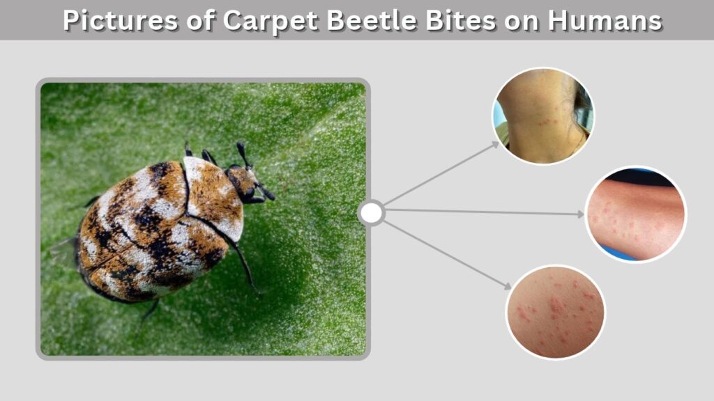 Pictures of Carpet Beetle Bites on Humans