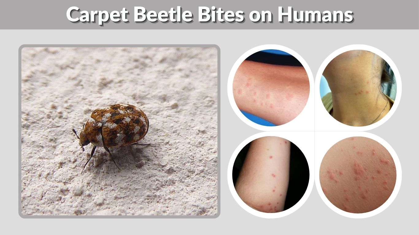 Carpet Beetle Bites on Humans: Symptoms & Treatment