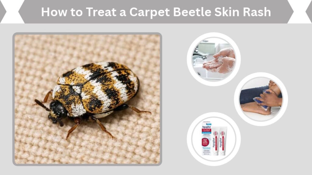 How to Treat a Carpet Beetle Skin Rash