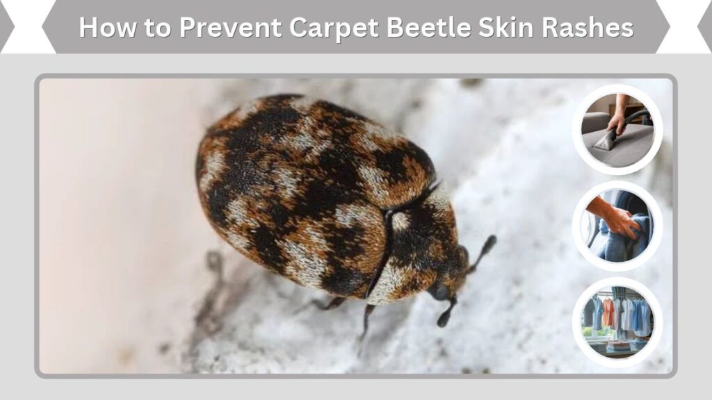 How to Prevent Carpet Beetle Skin Rashes