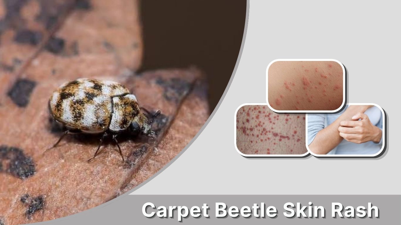 Carpet Beetle Skin Rash: Symptoms, Causes & Treatment