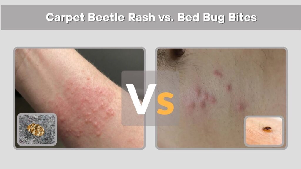 Carpet Beetle Rash vs. Bed Bug Bites