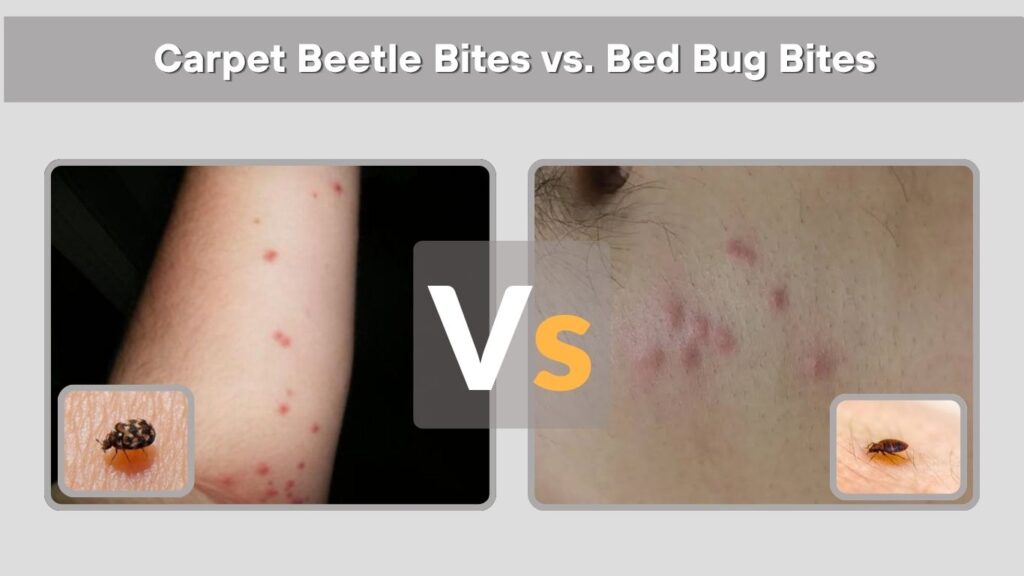 Carpet Beetle Bites vs. Bed Bug Bites